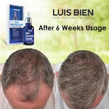 For boosting hair growth and getting flawless hair this season try this extremely glorious and nutrition filled oil recipe which would work miracles on your hair! Luis Bien Fast Hair Growth Serum Essential Oil Blue Serum Anti Hair Loss Liquid Hair Growth Treatment For Men Women Hair Care Aliexpress
