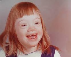 Valerie and David: Down Syndrome