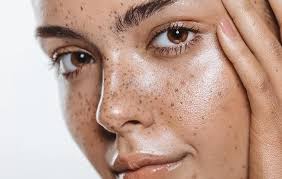 Scraping, with or without … Skin Clinic Cancer Laser Cosmetics Ivanhoe And Diamond Creek