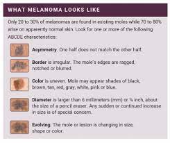 Pharmacodynamics the treatment of diseases, such as infectious diseases and cancers, through the application of chemicals that have specific effects. How To Detect Skin Cancer Roswell Park Comprehensive Cancer Center
