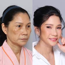 Dr. Tony Park (@dr.tony_dubai) • Instagram photos and videos