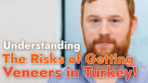 The Risks of Getting Veneers in Turkey
