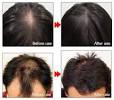 Regrow Hair Products