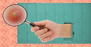 This would be an unusual place for an ingrown hair to occu. Is It Herpes Or An Ingrown Hair Stop Webmding We Ve Got The Facts By Paige Moomey Omgfacts Medium