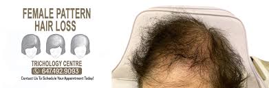 It also takes longer for new hair to begin growing. What Is Female Pattern Hair Loss Trichology Centre