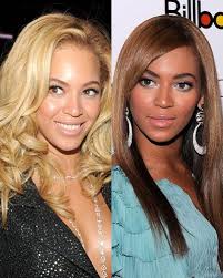 Before And After Black And White Bleaching Cream Reviews Pin On Gory Crazy Morbid Crimes Plastic Surgery Anything Messed Up