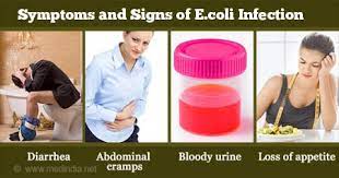 E. Coli Infection | Escherichia Coli Infection - Causes, Diagnosis,  Symptoms, Treatment, Risk Factors & Prevention