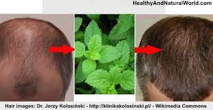 100 ml of castor oil; How To Use Peppermint Essential Oil For Hair Growth
