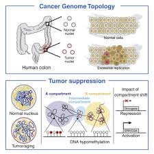 The cancer cells that move to other parts of the body are the same as the original ones, but they have the ability to. Large Scale Topological Changes Restrain Malignant Progression In Colorectal Cancer Sciencedirect