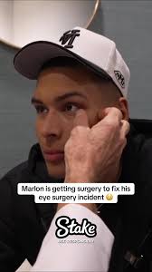 Why Does Marlon Have A Bad Eye