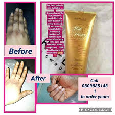 Check spelling or type a new query. Use Loving Care Body Lotion To Get Rid Of That Spots On Your Skin And Children Health Nigeria