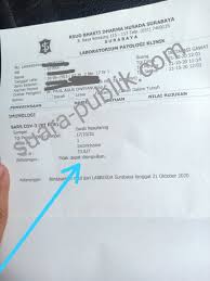 Rs Bdh Terbitkan Hasil Test Swab Abu Abu Umam Tanyakan Ke Labkesda