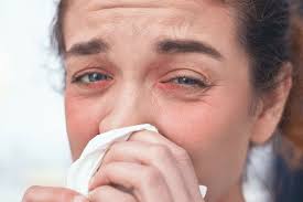 Best Ways to Handle Eye Allergies