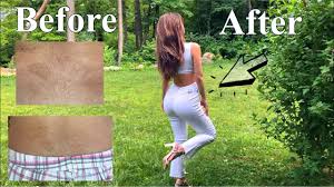 I surprised to learn laser can actually help with irritating af ingrown hairs.aside from clearer most people report 90 percent permanent reduction in hair growth but fluctuating hormones can make hair grow back. At Home Laser Hair Removal Lower Back Body Hair Who Is She Youtube