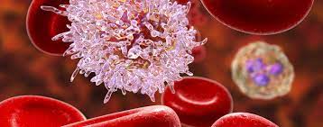 Non Hodgkin Lymphom Focus Arztsuche