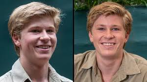 Fans Had No Idea Things Were This Bad for Robert Irwin