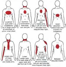 Spoedzorgnet On Twitter Signs Of Heart Attack Heart Attack Symptoms Medical Information
