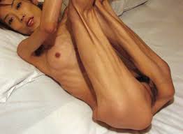 Anorexic Asian Porn 27 Porn Photo 660 | Hot Sex Picture