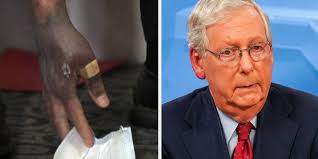 We passed a bold plan called the cares act to assist families, workers, small businesses and medical professionals. Mitch Mcconnell S Hand Discolored He Says He S Healthy