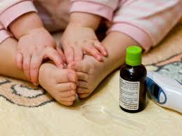 Ganz auf die leichte schulter nehmen sollten eltern die krankheit ohnehin nicht. Hand Fuss Mund Krankheit Sehr Ansteckend Aber Harmlos Berlin De