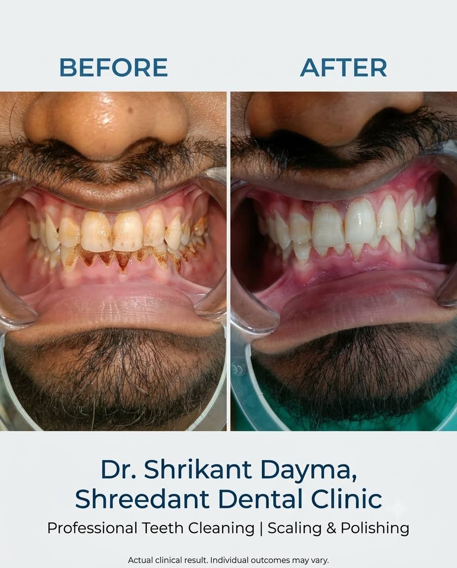 professional teeth cleaning and Polishing product image