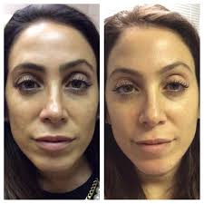 Huntington Dermatology & Cosmetic Associates, PC