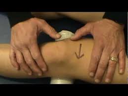 Image result for Patellar Apprehension Test