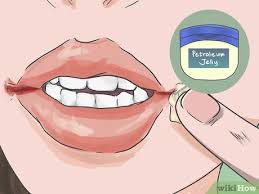 3 Ways To Heal Cracks In The Corners Of Your Mouth Wikihow
