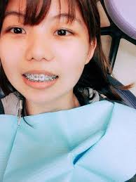 Chicas Con Frenos」おしゃれまとめの人気アイデア｜Pinterest｜Jacob Acuña