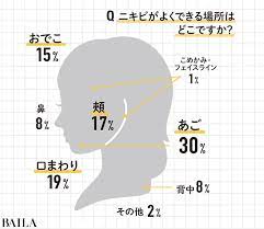 大人ニキビまとめ 気になる大人ニキビを克服する方法 baila 大人ニキビ ニキビ アクネケア