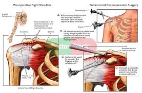 Pin On Health Pain Management