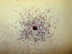 A gunshot wound (gsw) is physical trauma caused by a projectile from a firearm. 7 Work Forensics Gsws Ideas Forensics Forensic Science Forensic Anthropology