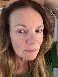 Well put a Band-Aid under my eye and call me Nelly bc it's HOT IN HERRE  🥵🥵🥵🩹