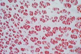 Cross section of a human bone showing bone marrow, spongy bone and blood vessels. Cross Section Human Cartilage Bone Under Microscope View For Stock Photo Picture And Royalty Free Image Image 104343987