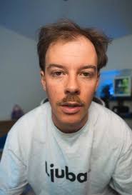 Adi Totoro (26): Schweizer Influencer kämpft mit Haarausfall