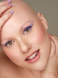 Alopecia: 'I decided I'd had enough of hiding my real self'