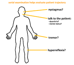 Acute lithium toxicity is generally subdivided into three grades: Lithium Intoxication Emcrit Project
