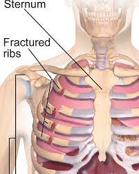 Pin On Health Pain Relief