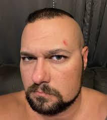 Battle scars! A knot