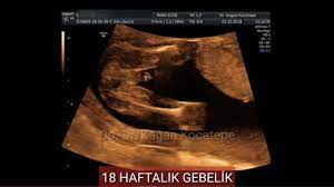 pin on 18 haftalik yaklasik 4 aylik erkek bebek