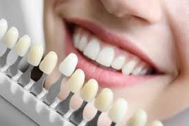 Tooth Colour For Dentures In Victoria Bc Postings Denture