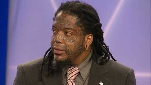 Judge says former mayoral candidate doesn't 'get it,' slams him with  tougher sentence