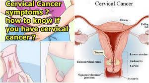 Signs that warrant an immediate trip to a doctor some common cancer signs that should result in a visit to the emergency room or to a doctor as soon as possible include: What We Know About Cervical Cancer Posts Facebook
