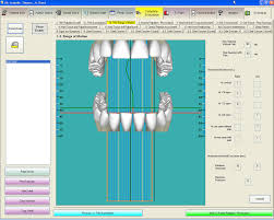 tce tmj chart large screen view