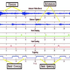 How to check your application status. Emg Signals With Emg Triggered Status Download Scientific Diagram
