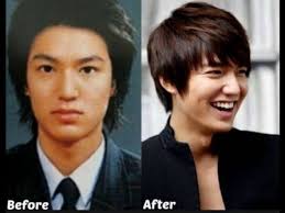 Permalink To Best Korean Actors Plastic Surgery Before And After Photos