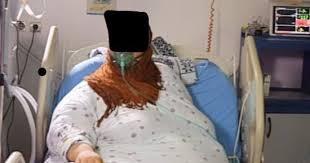 صور تفاصيل إجراء جراحة قيصرية وتكميم لسيدة تزن 300 كجم فى جامعة المنصورة المريضة مستشفيات كثيرة رفضتنى بعد معرفتهم بحملى بحجة عدم الإمكانيات واستعدادات الولادة مروة المستشفى حجزتنى لحين انتهاء الولادة