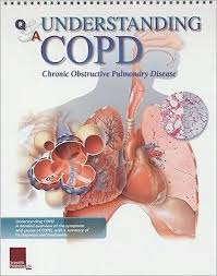 Understanding Copd Flip Chart Book Other Format