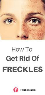 Freckles are tiny brown spots most often seen in people having fair complexion. 23 Getting Rid Of Freckles Ideas Getting Rid Of Freckles Freckles Freckle Remover