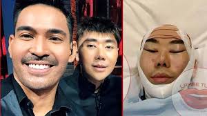 Ada Gigi Kelinci di Penampilan Roy Kiyoshi Terbaru, Dagu Juga Tambah  Panjang